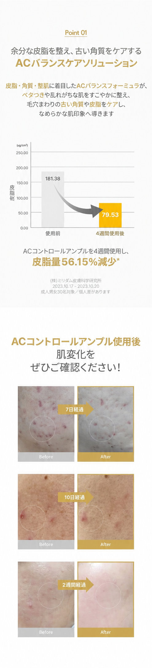インナードライ肌の皮脂と乾燥を整えるケア