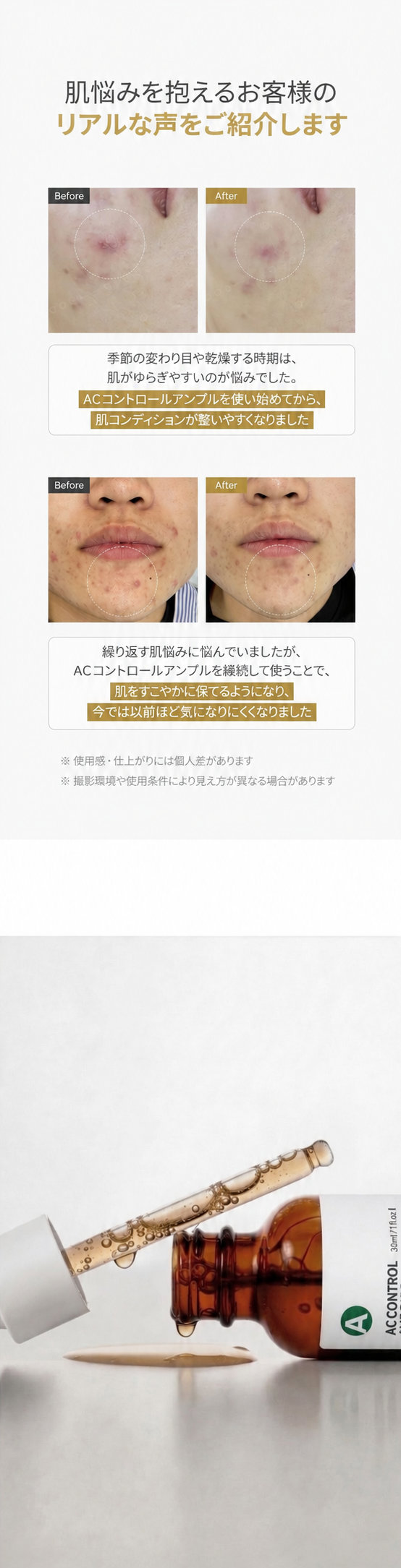 すこやかな肌状態を目指すACコントロールケア
